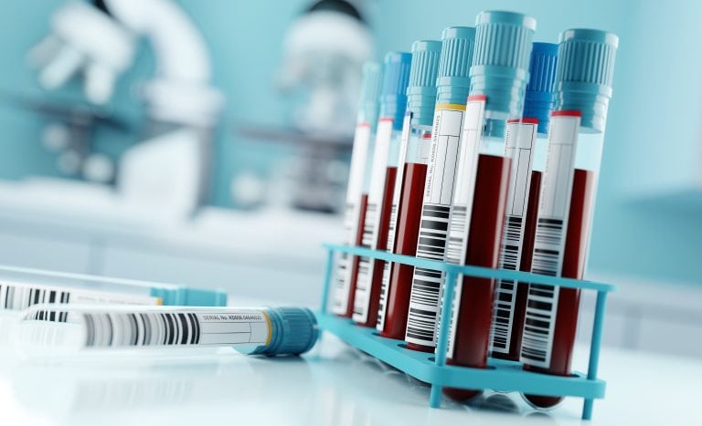 PFAS medical monitoring